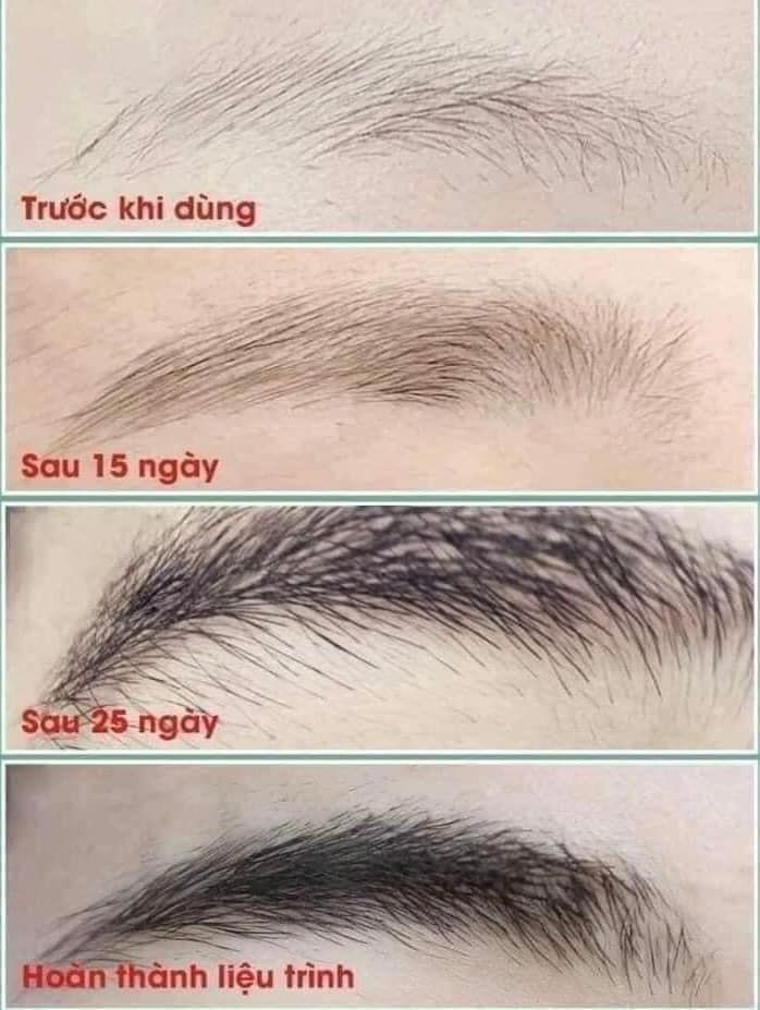Tinh Chất Serum Dưỡng Mày FEG Eyebrow Enhancer 100% natural USA 3ml